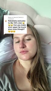 Hahahaha Welcome to The 10 Club Can You Make Your Upper Lip Touch Your Nose  Though