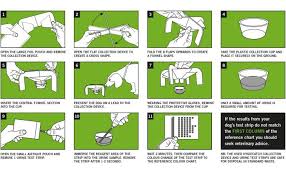 Image result for Clean Catch Urine Collection