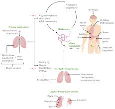 This is a transformative journal. Tuberculosis Concise Medical Knowledge