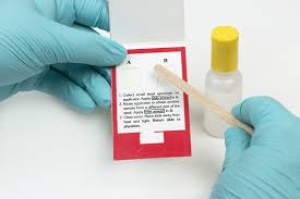The fecal occult (hidden) blood test (fobt) is a lab test used to check stool (feces) samples for hidden blood or blood products that may arise due to small amount of bleeding in the gastrointestinal tract. Faecal Occult Blood Test National Foundation For Digestive Diseases