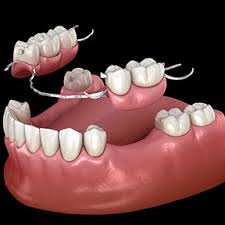 Image result for Multidentia exserta