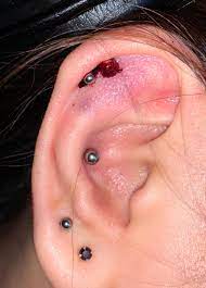 How To Care For Bleeding Helix Piercing Piercing