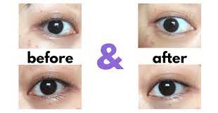Get Clearer Whiter Eyes Lumify Eye Drops Review White Eyes Eye Drops Eye Health
