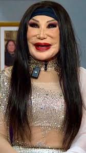 She was a famous actress who appeared in around 100 movies, but one tragic  mistake completely ruined her appearance. Many people are shocked to see  how she looked like before, and you better sit down ...