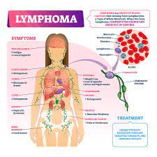 Leukemia And Lymphoma Important Information You Should Know Live Long Lyndhurst Health And Wellness Initiative