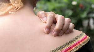 Image result for Notalgia Paresthetica