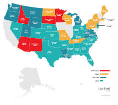 Average Cost Of Lap Band Surgery 2017 Price Survey