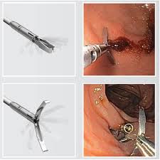 Dr. Amin siddiqui Best Gastroenterologist in Nagpur