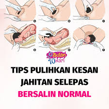 Selain berpantang, jahitan akibat guntingan ketika bersalin juga harus dijaga dengan baik. 9bulan10hari Tips Pulihkan Luka Kesan Jahitan Bersalin Facebook