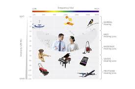 What Is A Degree Of Hearing Loss The Med El Blog