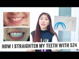 After you receive the kit, you'll take a dental impression at home and send them back to alignerco. How I Straighten My Teeth With Only 24 Really Effective Youtube