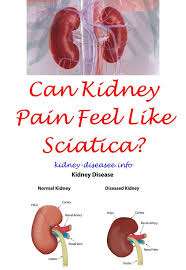 Common Symptoms Of Kidney Stones Kidney Kidney Symptoms Kidney Cyst Symptoms