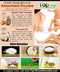 Prev3 Of 3next Post 9 Sea Salt Exfoliating Your Skin With A Sea Salt Scrub Can Help Unclog The Skin Pores And S Keratosis Pilaris Skin Remedies Skin Disorders
