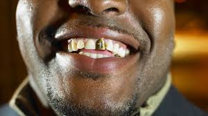3.3 out of 5 stars 395. Gold Teeth Are Not Gold Teeth They Are Grillz And They Are Extremely Cool Wolfie Wolfgang
