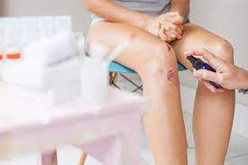 Choose from a wide range of similar scenes. Is That Cut Or Scrape Infected Here The Signs The Healthy