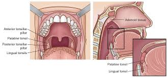 tonsil cancer head and neck cancer info for teens