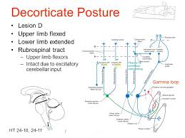 Brainstem Spinal Systems Ppt Video Online Download