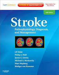 Image result for Stroke Pathophysiology