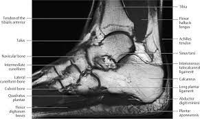 Mri findings of acute turf toe: Ankle And Foot Radiology Key