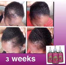 Since its launch, canvas beauty brand has helped thousands of men and women restore confidence in their hair. Canvas Beauty Brand All Natural Hair Care Products Hair Growth For Men Natural Hair Styles Natural Hair Recipes