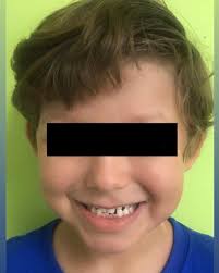 Dr. Gilberto Saenz (@dr.saenz.odontopediatra) • Instagram photos and videos