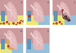 Image result for Pleiotaxis