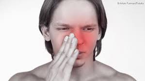 Sie sollen sich in geduld üben. Stirnhohlenentzundung Ursachen Symptome Therapie Netdoktor