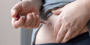 7,4 prozent der patienten ließen eine lippenvergrößerung vornehmen, berichtet die deutsche gesellschaft für. Diabetes Orale Einnahme Statt Insulinspritze Heilpraxis