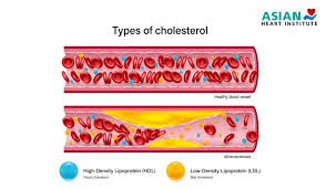Image result for LDL Cholesterol