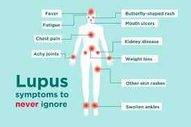 Lupus is an autoimmune disease — meaning the immune system doesn't function properly and attacks a person's own body by mistake — and it affects multiple organs throughout the body. Lupus Signs And Symptoms How To Tell If You Could Have Lupus