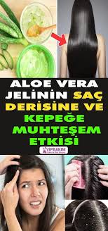 Aloe Vera Jelinin Sac Derisine Ve Kepege Muhtesem Etkisi Kepeklisaclar Aloevera Sacbakimi Dietforgoodhealth In 2020 Nutrition Recipes Nutrition Healthy Nutrition