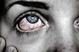 Geplatzte Ader Im Auge Schlimm Oder Harmlos