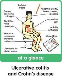 The Truth About Crohn S Disease Dispelling The Myths Ulcerative Colitis Nursing Crohns Disease Crohns Disease Symptoms
