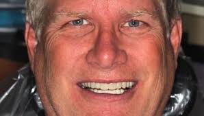 Cosmetic Dentistry Before & After Photos