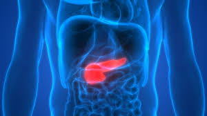 Signs and symptoms of pancreatic cancer — such as pain in the upper abdomen, yellow skin and eyes, and weight loss. Pancreatic Cancer Diagnosis And Symptoms Echelon Health