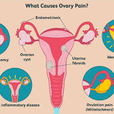 Unfortunately, symptoms of ovarian cancer are vague, causing women to delay seeking care. Ovary Pain Causes Treatment And When To See A Doctor