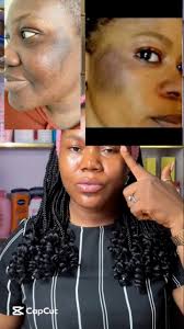 Shop with us, Authentic skincare products for a flawless and radiant skin  glow , ‼️ALSO AVAILABLE IN WHOLESALE PRICE !‼️, To place an order, kindly  send a dm or Click