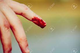 Когда любовь остывает, blood, tears and gold. Index Finger On Human Hand Or Palm Is Cut Hurt And Bleeding With Stock Photo Picture And Royalty Free Image Image 65704019