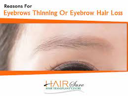 The most common cause is the imbalance of thyroid hormones. Reasons For Eyebrows Thinning Or Eyebrow Hair Loss Hair Sure