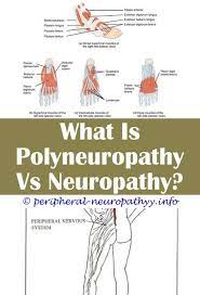 Pin On Neuropathy Treatment