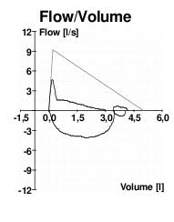 Pulmonary Function Testing Pft Made Simple Iowa Head And Neck Protocols