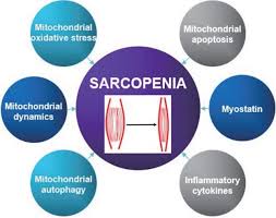 Sarcopenia is a progressive and generalised skeletal muscle disorder, characterised by low muscle strength, low muscle quality or quantity, and. Role Of Exercise In Age Related Sarcopenia
