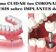 Implantes post-extracción y el uso de cicatrizadores ...
