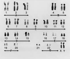 Genes And Chromosomes Fundamentals Merck Manuals