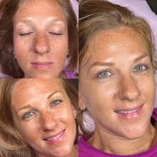 Check out my clients before & after photos