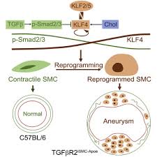 Smooth muscles are found in the hollow organs like the stomach, intestine, urinary bladder and uterus, and in the walls of myosin is primarily class two in the smooth muscle and actin is the thin filament that takes part in the contractile machinery composed of alpha and. Smooth Muscle Cell Reprogramming In Aortic Aneurysms Sciencedirect