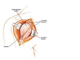 Your upper arm bone (humerus), your shoulder blade (scapula), and your collarbone (clavicle). Seminar On Applied Anatomy And Surgical Approaches To Shoulder