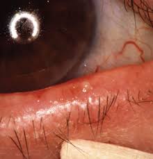 Image result for Blepharis gazensis