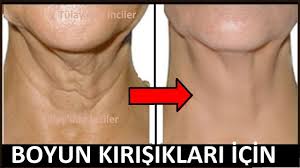Boyun Kirisiklari Icin Kirisik Giderici Yumurta Maskesi Guzellik Bakim Anti Aging Krem Dogal Cilt Bakimi Cilt Bakimi