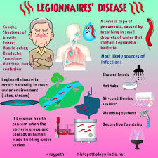Image result for Legionella